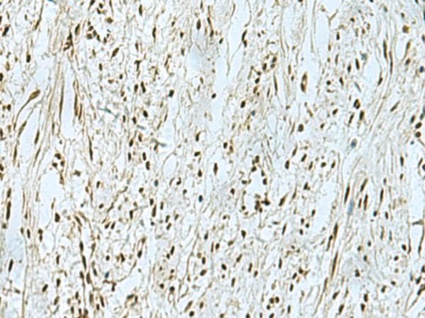 THTPA Antibody