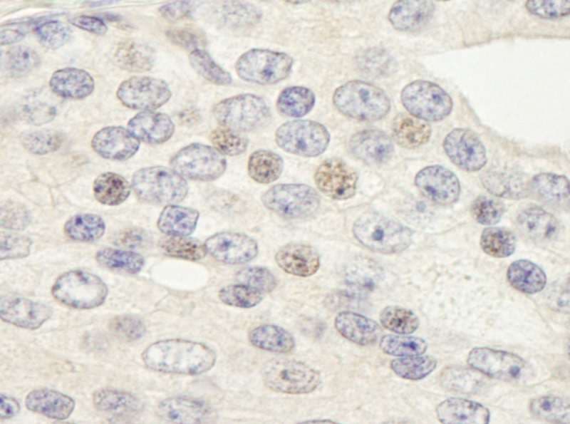 Polyclonal Rabbit anti-Human ZNF592 Antibody (aa950-1000, IHC)