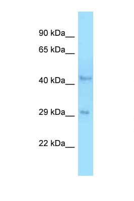 Polyclonal Rabbit anti-Rat B4GALT3 Antibody (C-Terminus, WB)