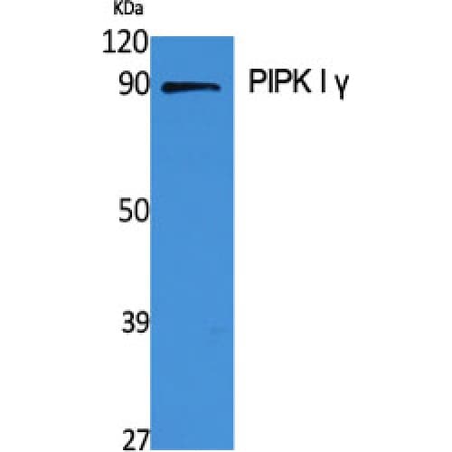 PIP5K1C Antibody (280-360 aa, Internal)