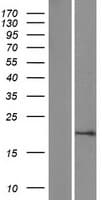 SUMO1 / SMT3 Protein (Over-Expression Lysate Myc-DDK (Flag))