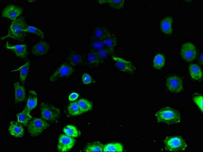 Polyclonal Rabbit anti-Human GJB7 / CX25 / Connexin 25 Antibody