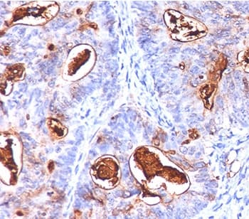 CEA / Carcinoembryonic Antigen Antibody (clone COL-1 + CEA31 + C66/261, Ready-to-Use)
