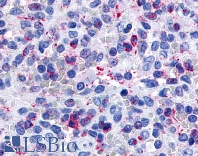 IHC-plus™ P2Y13 / P2RY13 Antibody (Extracellular Domain)