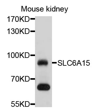 Polyclonal Rabbit anti-Human SLC6A15 / SBAT1 Antibody (aa350-450, WB)