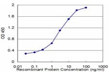 EPB41L1 / 4.1N Antibody (clone 2D10)