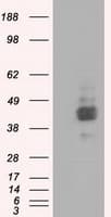 IHC-plus™ Basigin / Emmprin / CD147 Antibody (clone 5D8)