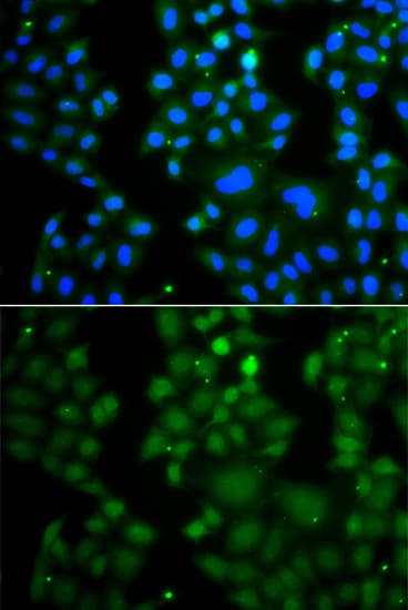 RNF125 / TRAC-1 Antibody