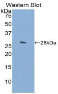 HGF / Hepatocyte Growth Factor Antibody (aa495-728, APC)