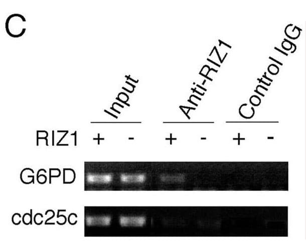 PRDM2 / RIZ1 Antibody (clone 33AT1045)