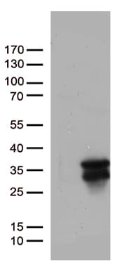 MGMT Antibody (clone UMAB56)