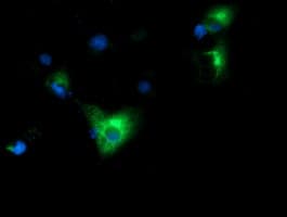 HP / Haptoglobin Antibody (clone OTI6H2)
