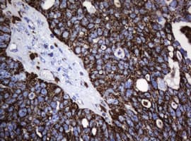 PathPlus™ HSPD1 / HSP60 Antibody (clone OTI3A2)