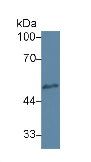 HPSE / Heparanase Antibody (APC)