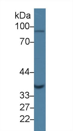 GLRX3 / Glutaredoxin 3 Antibody (aa10-117)