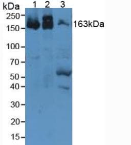 A2M / Alpha-2-Macroglobulin Antibody (aa1053-1214)