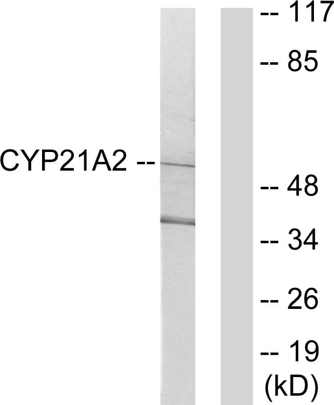 IHC-plus™ CYP21A2 Antibody (aa151-200)