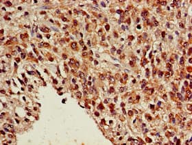 NR5A2 / LRH-1 Antibody