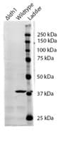 Polyclonal Goat anti-Human IDH1 / IDH Antibody (aa281-295, WB)