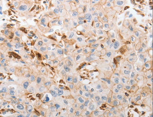 SLC15A2 / PEPT2 Antibody