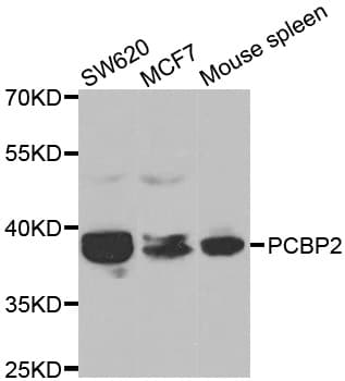 IHC-plus™ Polyclonal Rabbit anti-Human HNRNP-E2 / PCBP2 Antibody (IHC, IF, WB)