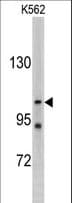 LLGL2 Antibody (aa940-973)