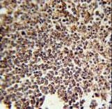 KIR2DS3 Antibody (aa268-295)