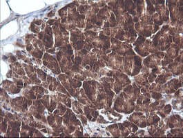CTAG1B / NY-ESO-1 Antibody (clone OTI4C12)