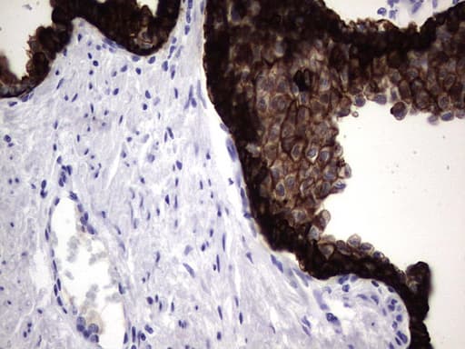 Monoclonal Mouse anti-Human KRT19 / CK19 / Cytokeratin 19 Antibody (clone OTI1E7, aa240-390, IHC)