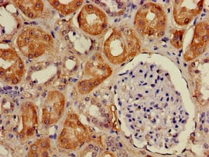 Polyclonal Rabbit anti-Human DDA1 Antibody (IHC, IF, WB)