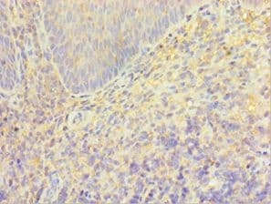 TRPM2 Antibody (aa1204-1503)