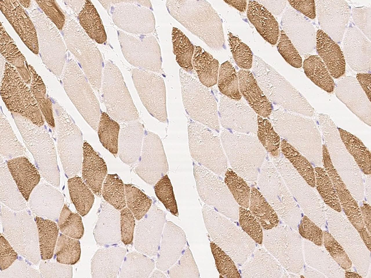 TPM1 / Tropomyosin Antibody