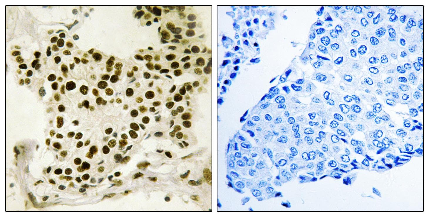 UBTF / UBF Antibody (phospho-Ser484)