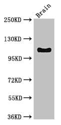 Polyclonal Rabbit anti-Human DSG3 / Desmoglein 3 Antibody (WB)