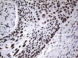 NBN / Nibrin Antibody (aa183-460, clone OTI2F5, Carrier-free)
