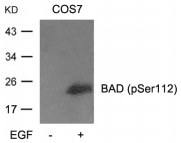 Polyclonal Rabbit anti-Mouse BAD Antibody (IHC, WB)