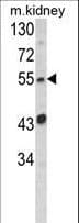BAP / SIL1 Antibody (aa99-126)