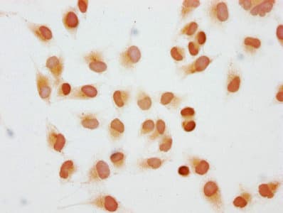 HIST1H1C Antibody