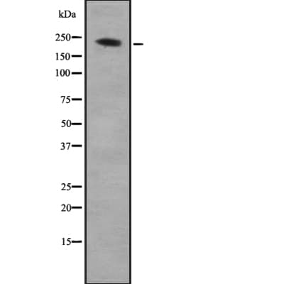 ARHGEF17 / TEM4 Antibody
