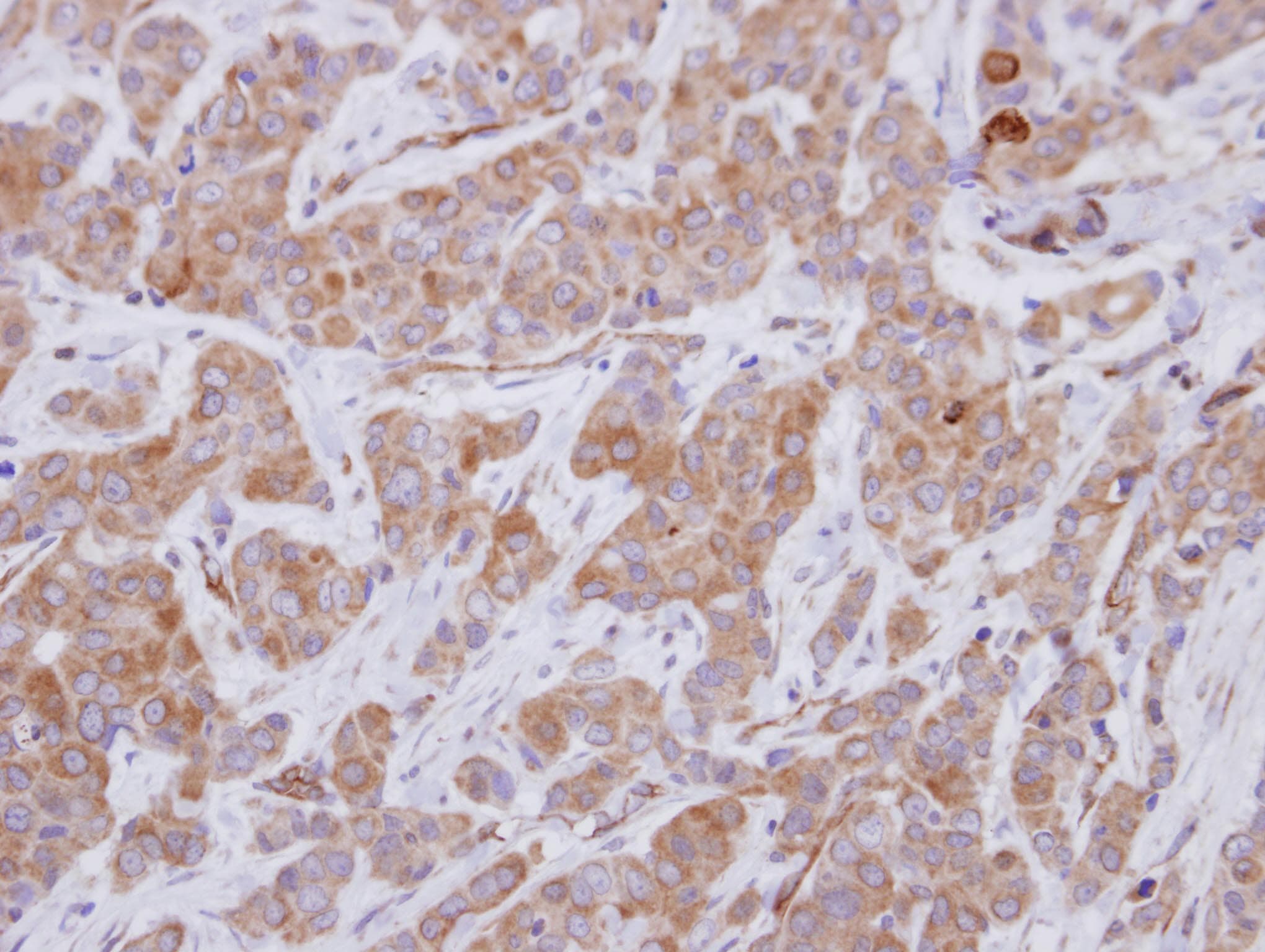 Polyclonal Rabbit anti-Human ARHGEF25 / GEFT Antibody (IHC, WB)