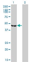 IHC-plus™ ENO3 / Enolase 3 Antibody (clone 5D1)