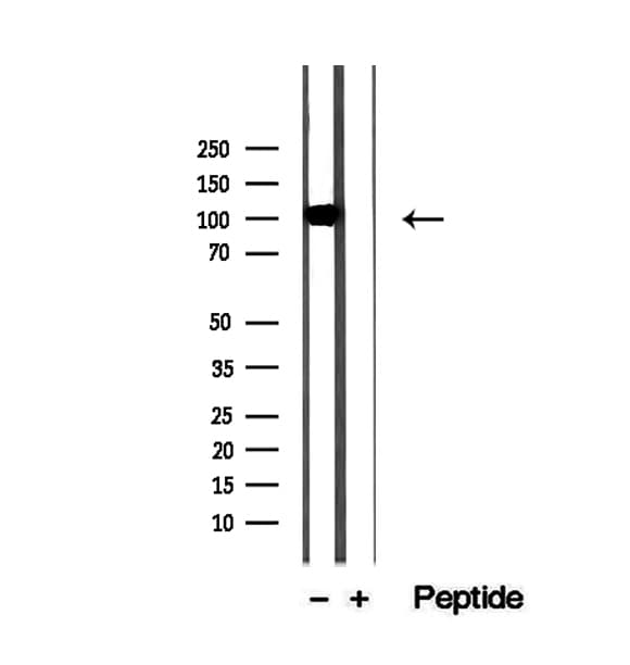 Polyclonal Rabbit anti-Human PDE6A / PDE6 Alpha Antibody (IHC, WB)