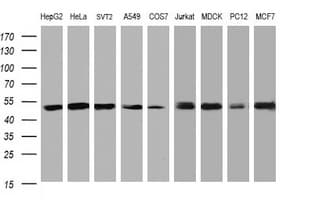 PAI-RBP1 / SERBP1 Antibody (clone OTI2F6)