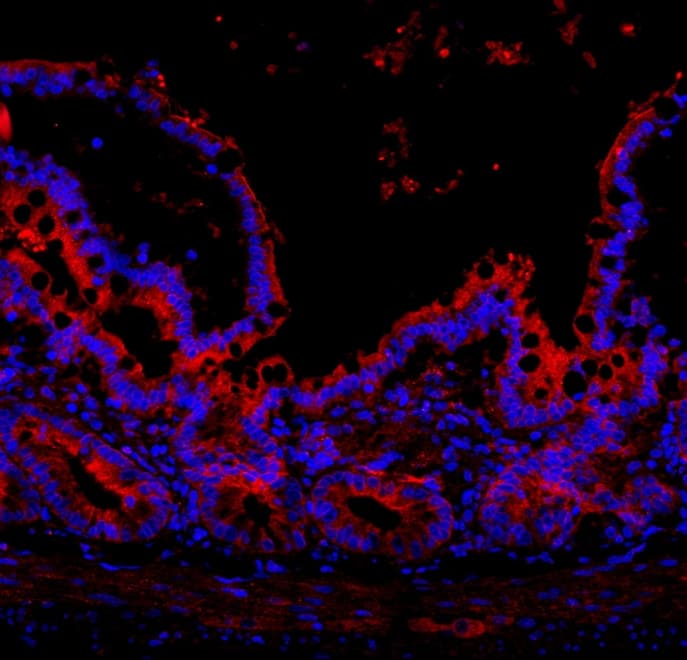 NALP3 / NLRP3 Antibody (aa12-31)