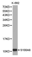 S100A8 / MRP8 Antibody