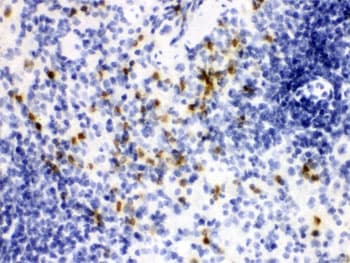 LCN2 / Lipocalin 2 / NGAL Antibody
