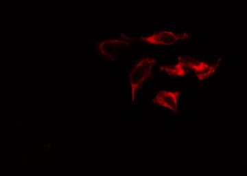 Mannose Receptor / CD206 Antibody