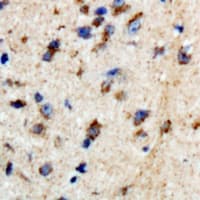 BTBD6 Antibody (Internal)