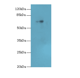 Polyclonal Rabbit anti-Human HEATR9 Antibody (IHC, WB)
