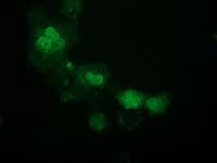 IHC-plus™ Monoclonal Mouse anti-Human ATP6V1F Antibody (clone 5F10, IHC, IF, WB)